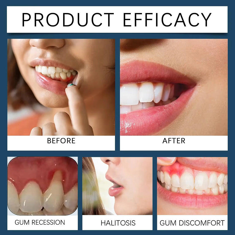 Grantedti® Gum Protect Repair Gel