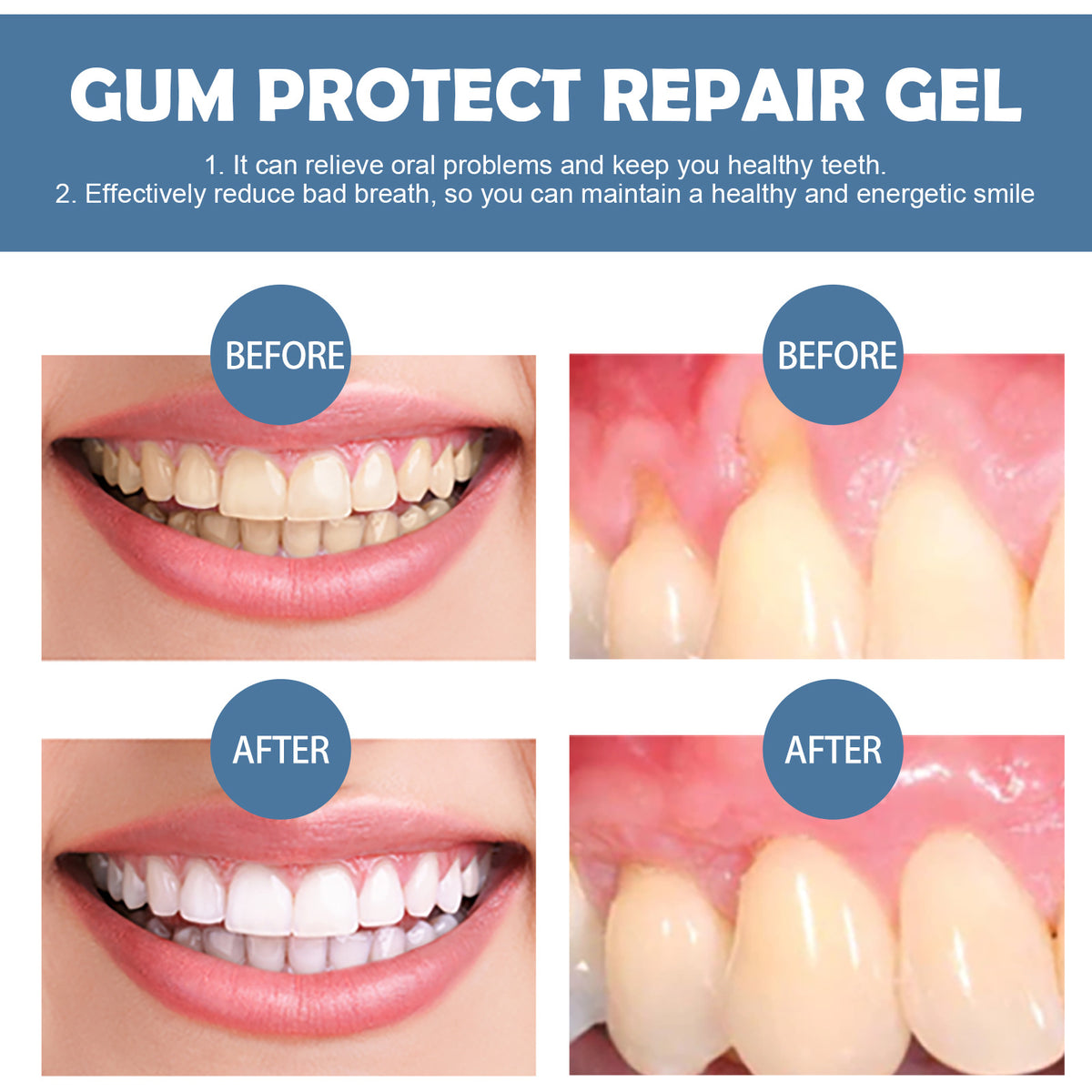 Grantedti® Gum Protect Repair Gel